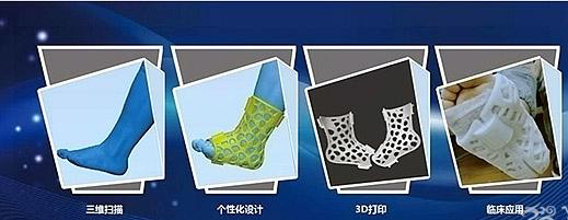 國(guó)內(nèi)首個(gè)3D打印醫(yī)療中心落戶(hù)重慶