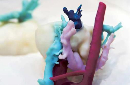 迪拜計劃在所有醫(yī)院中應用3D打印技術