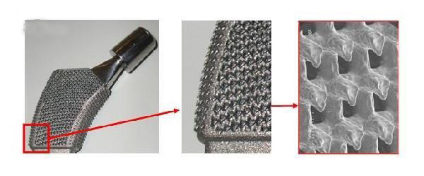帶數(shù)百個小爪的新3D打印骨植入物使用壽命更長