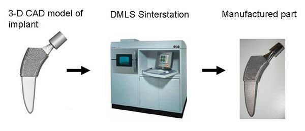 帶數(shù)百個小爪的新3D打印骨植入物使用壽命更長